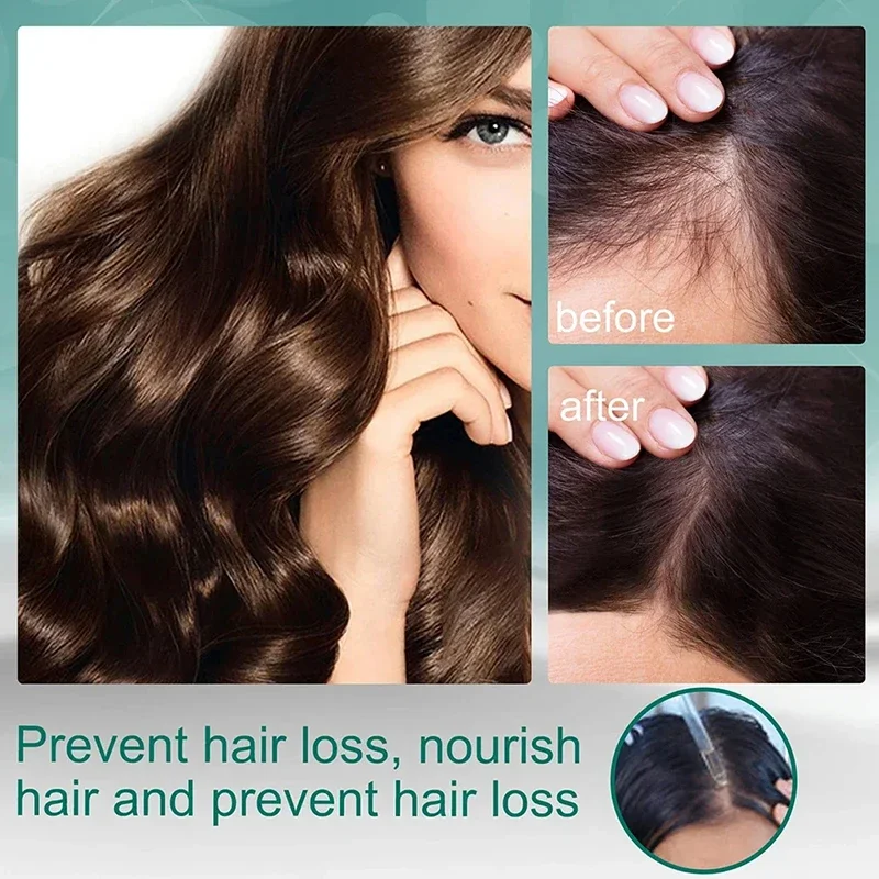 Behandeling Vloeistof Vier kru - Hair Care Natural Ingredients recensie en prijs