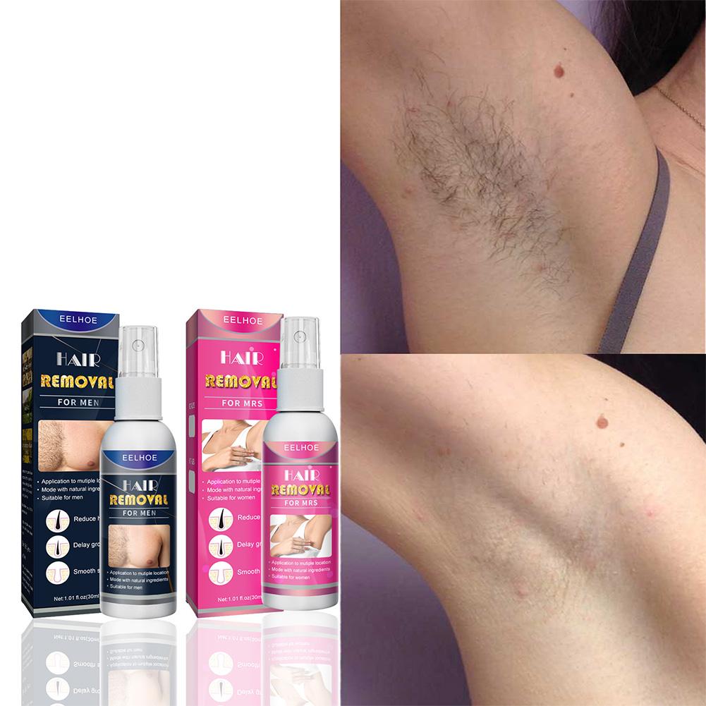 1/2 STUKS Super Natuurlijke Pi - Hair Care Lotion recensie en prijs